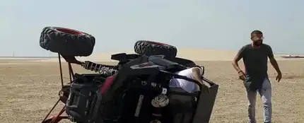Gerard Piqué, tras su accidente con un buggy Gerard Piqué, tras su accidente con un buggy