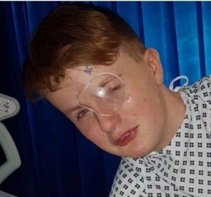 Un niño de 15 años se queda ciego de un ojo después de que un compañero le clavase una pluma Un niño de 15 años se queda ciego de un ojo después de que un compañero le clavase una pluma