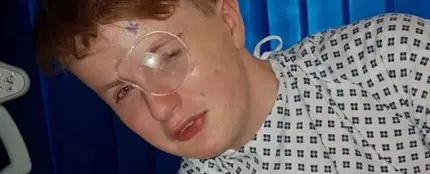 Un niño de 15 años se queda ciego de un ojo después de que un compañero le clavase una pluma Un niño de 15 años se queda ciego de un ojo después de que un compañero le clavase una pluma