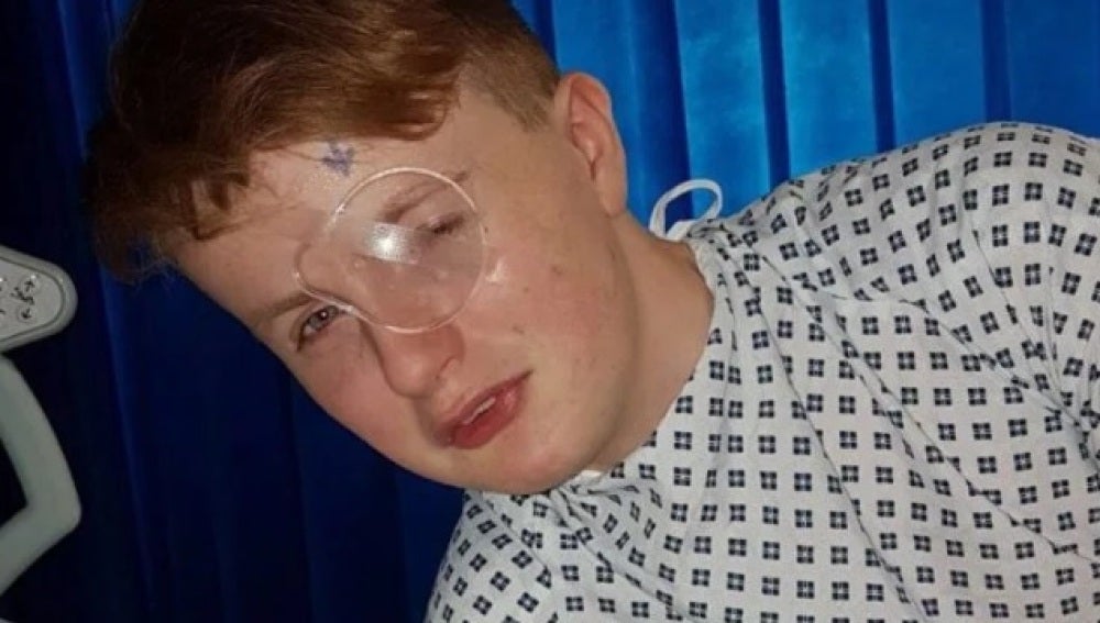Un niño de 15 años se queda ciego de un ojo después de que un compañero le clavase una pluma