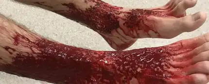 Los pies de Sam Kanizay tras el ataque de las criaturas Los pies de Sam Kanizay tras el ataque de las criaturas
