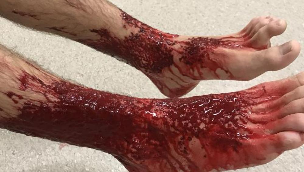 Los pies de Sam Kanizay tras el ataque de las criaturas