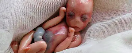 Willow, la bebé que nació muerta con 5 meses Willow, la bebé que nació muerta con 5 meses