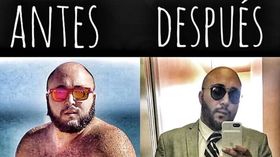 Kiko Rivera, el antes y el después de la operación Kiko Rivera, el antes y el después de la operación