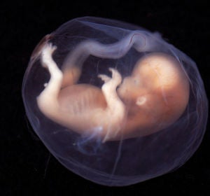 La tecnica de los tres padres geneticos es eficaz en problemas de infertilidad La tecnica de los tres padres geneticos es eficaz en problemas de infertilidad