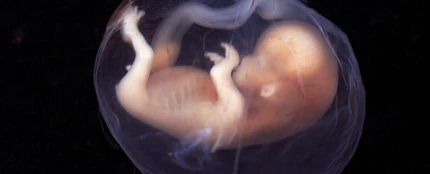 La tecnica de los tres padres geneticos es eficaz en problemas de infertilidad La tecnica de los tres padres geneticos es eficaz en problemas de infertilidad