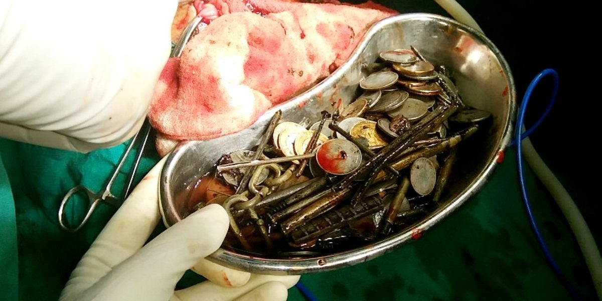 Extraen 263 monedas del cuerpo de un paciente, además de clavos y cuchillas de afeitar