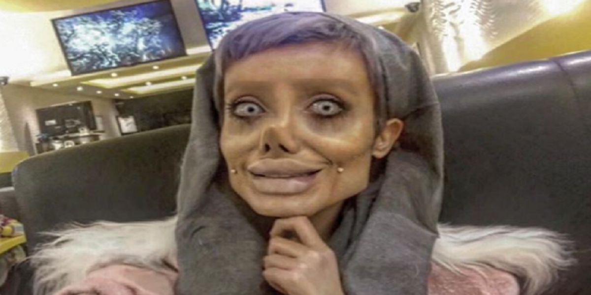 Sahar Tabar, la joven que quería parecerse a Angelina Jolie