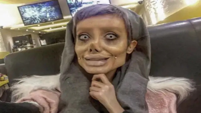 Sahar Tabar, la joven que quería parecerse a Angelina Jolie