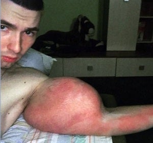 Uno de los bíceps del 'Popeye ruso' Uno de los bíceps del 'Popeye ruso'