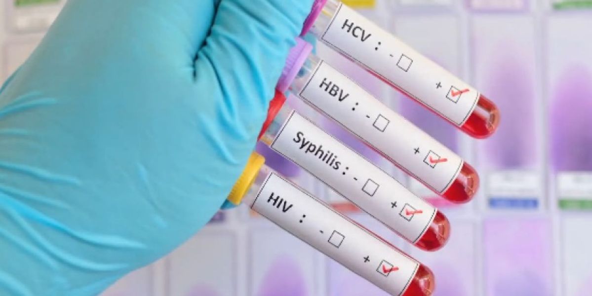 Infecciones de transmisión sexual
