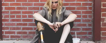 Lauren Wasser, la modelo que perdió una pierna por el TSS Lauren Wasser, la modelo que perdió una pierna por el TSS