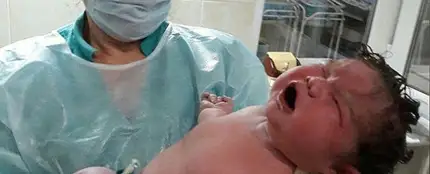 Uno de los médicos sosteniendo a la bebé recién nacida Uno de los médicos sosteniendo a la bebé recién nacida