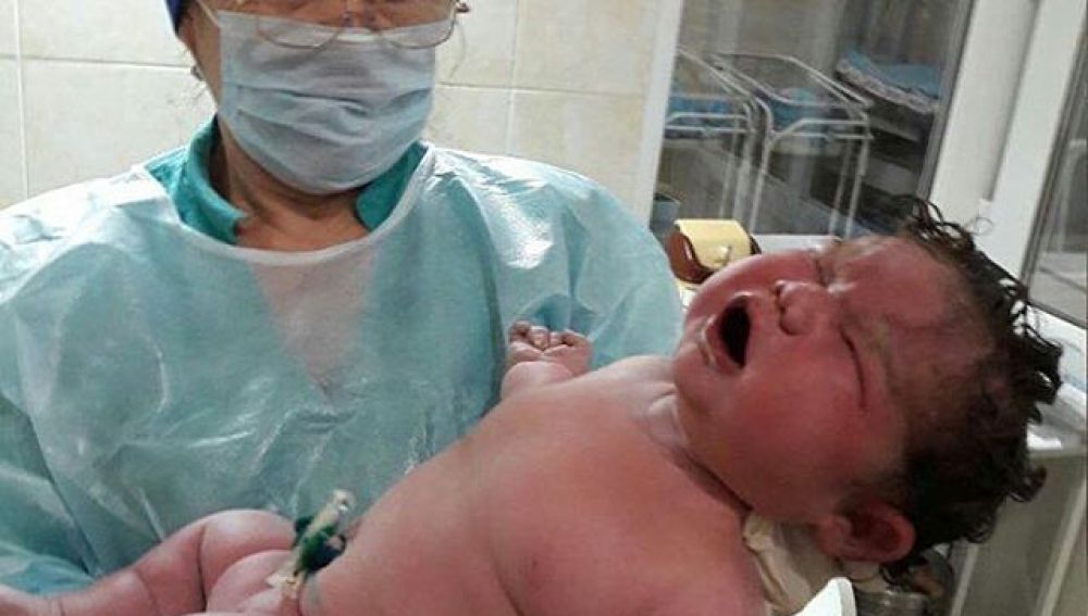 Uno de los médicos sosteniendo a la bebé recién nacida
