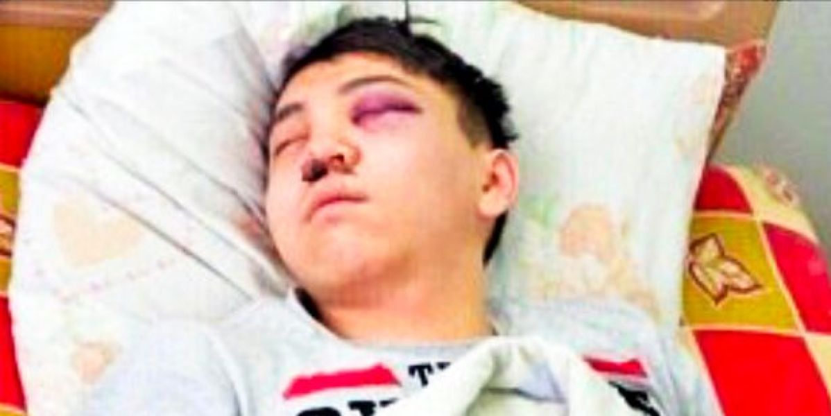 El hombre agredido por Zhanna Nurzhánova