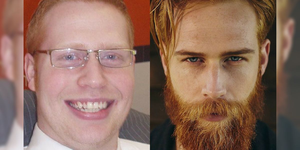 La vida de Gwilym Pugh cambió radicalmente al dejarse barba