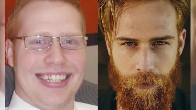 La vida de Gwilym Pugh cambió radicalmente al dejarse barba