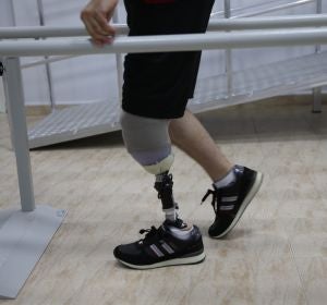 un hombre con su prótesis un hombre con su prótesis