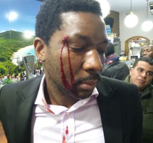 El actor, Marius Makon, muestra las heridas tras la agresión sufrida en un bar de Madrid El actor, Marius Makon, muestra las heridas tras la agresión sufrida en un bar de Madrid