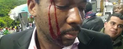 El actor, Marius Makon, muestra las heridas tras la agresión sufrida en un bar de Madrid El actor, Marius Makon, muestra las heridas tras la agresión sufrida en un bar de Madrid