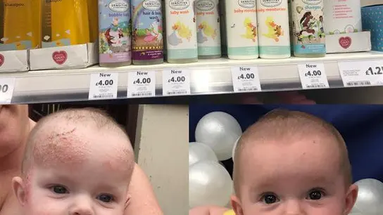 Una madre descubre una crema de bebés de 4 euros que cura el eczema infantil y la psoriasis adulta Una madre descubre una crema de bebés de 4 euros que cura el eczema infantil y la psoriasis adulta