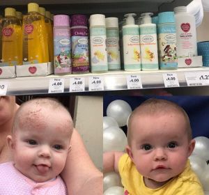 Una madre descubre una crema de bebés de 4 euros que cura el eczema infantil y la psoriasis adulta Una madre descubre una crema de bebés de 4 euros que cura el eczema infantil y la psoriasis adulta