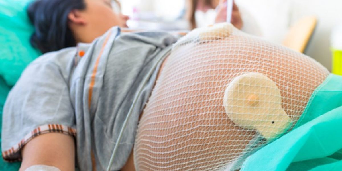 Imagen de una mujer embarazada en el momento del parto