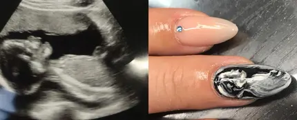 Imagen de la manicura con la ecografía escaneada Imagen de la manicura con la ecografía escaneada