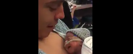 Reacción de un bebé prematuro al primer beso de su padre Reacción de un bebé prematuro al primer beso de su padre