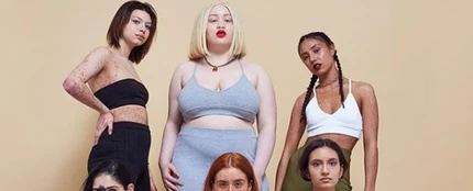 La campaña de moda que resalta las "imperfecciones" de la piel: #InYourOwnSkin La campaña de moda que resalta las "imperfecciones" de la piel: #InYourOwnSkin