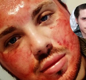 Un joven se somete a numerosas operaciones para parecerse a Brooklyn Beckham Un joven se somete a numerosas operaciones para parecerse a Brooklyn Beckham