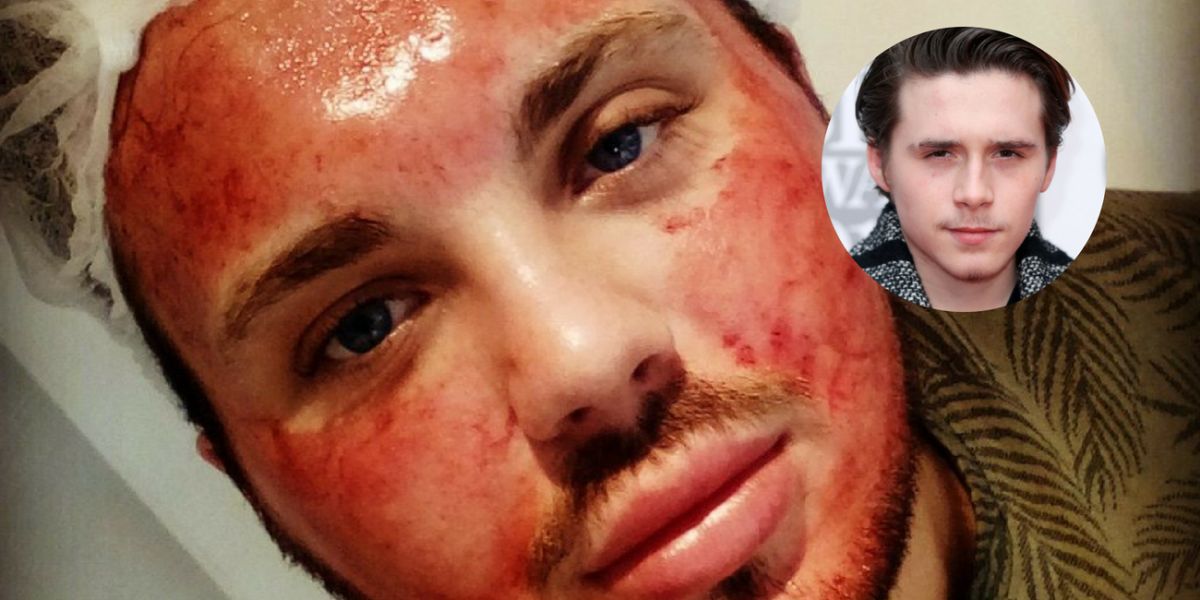 Un joven se somete a numerosas operaciones para parecerse a Brooklyn Beckham