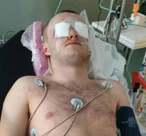 Imagen del joven escocés que recibió un disparo en los ojos con una pistola de pintura en Magaluf Imagen del joven escocés que recibió un disparo en los ojos con una pistola de pintura en Magaluf