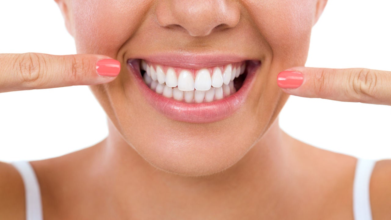 Dientes blancos Dientes blancos