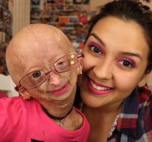 Adalia Rose junto a su madre, Natalia Pallante Adalia Rose junto a su madre, Natalia Pallante