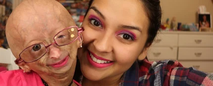 Adalia Rose junto a su madre, Natalia Pallante Adalia Rose junto a su madre, Natalia Pallante