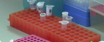 Pruebas de ADN Pruebas de ADN