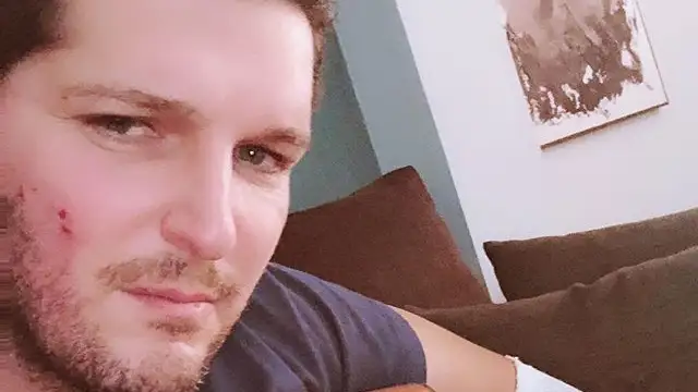 Manu Tenorio se recupera favorablemente de las heridas del accidente doméstico que sufrió
