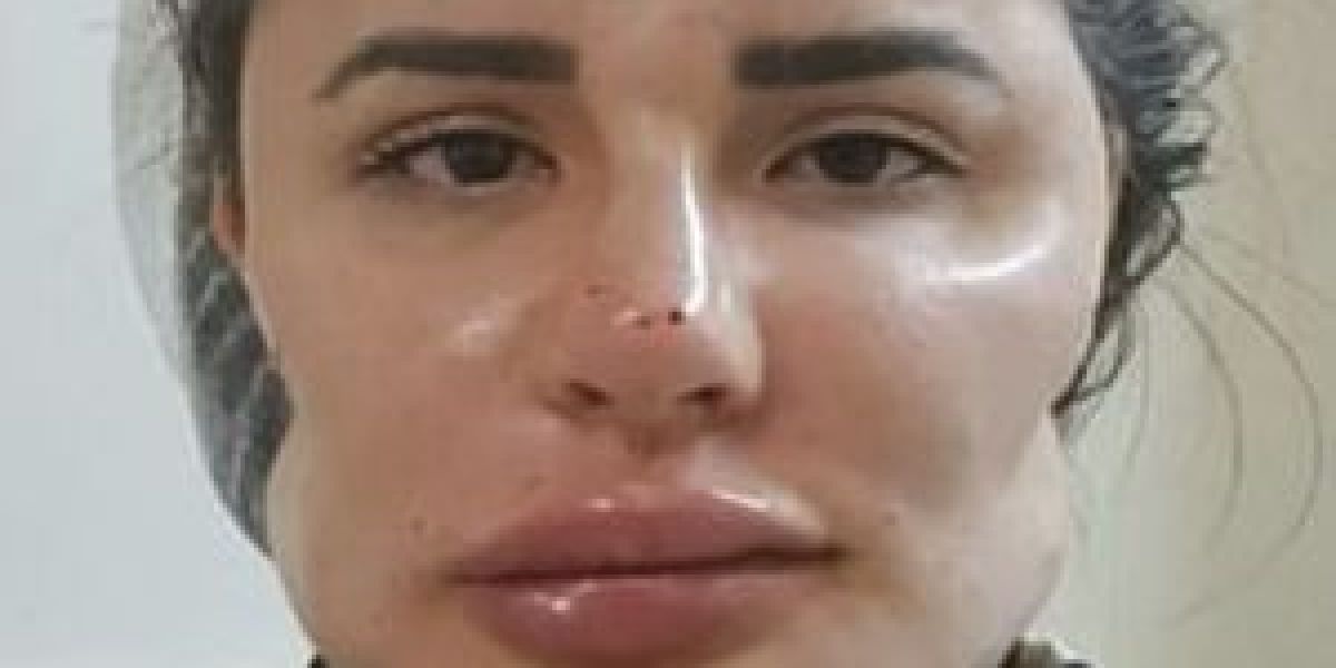 Paciente afectada por el cirujano