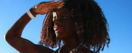 Una mujer blanca "cambia de raza" con inyecciones de melanina Una mujer blanca "cambia de raza" con inyecciones de melanina