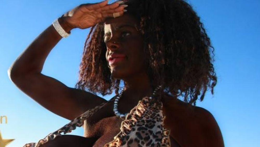 Una mujer blanca "cambia de raza" con inyecciones de melanina 