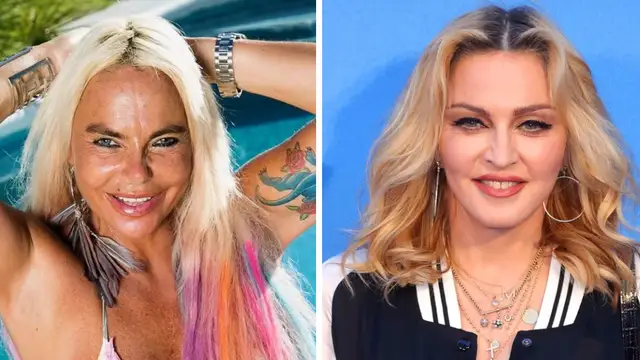 Leticia Sabater se opera para parecerse a Madonna
