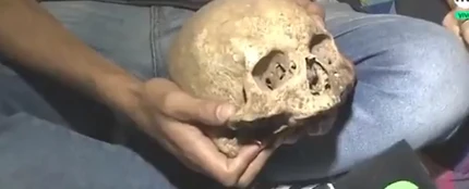 Un hincha argentino desentierra el cráneo de su abuelo Un hincha argentino desentierra el cráneo de su abuelo