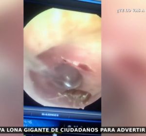 Acude al médico por un dolor de cabeza y descubre que tiene una cucaracha viviendo en el oído Acude al médico por un dolor de cabeza y descubre que tiene una cucaracha viviendo en el oído