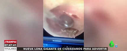 Acude al médico por un dolor de cabeza y descubre que tiene una cucaracha viviendo en el oído Acude al médico por un dolor de cabeza y descubre que tiene una cucaracha viviendo en el oído