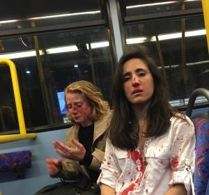 La pareja tras la agresión La pareja tras la agresión