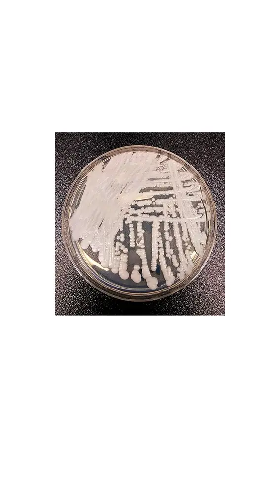 Hongo cándida auris Hongo cándida auris