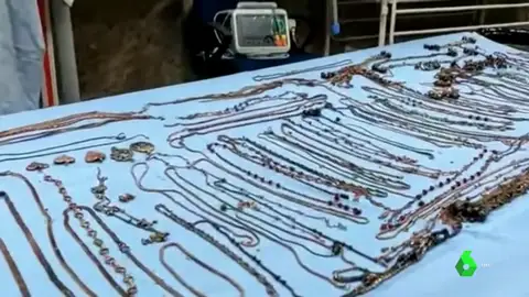 Joyas y monedas encontradas en el estómago de una joven de 22 años en la India. Joyas y monedas encontradas en el estómago de una joven de 22 años en la India.