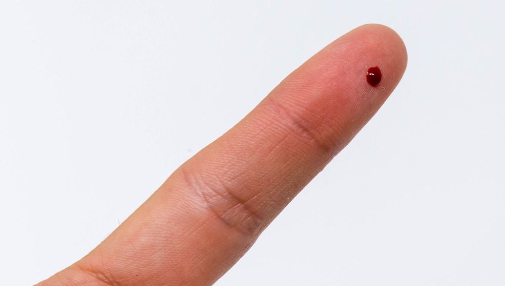 Prueba Coronavirus: Pinchazo en el dedo