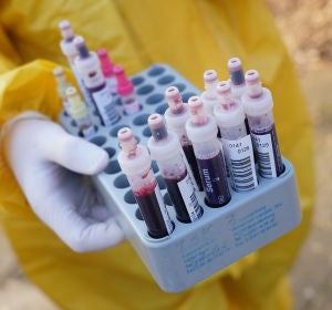 Coronavirus: Los nuevos síntomas de coronavirus Coronavirus: Los nuevos síntomas de coronavirus